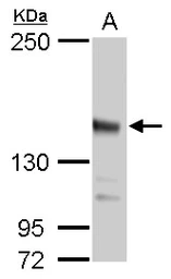 Anti-JARID2 antibody used in Western Blot (WB). GTX129019